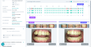 Schermata del Programma Dental Monitoring per il monitoraggio virtuale del Programma Sorridi con Martina