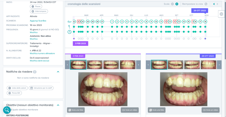 Schermata del Programma Dental Monitoring per il monitoraggio virtuale del Programma Sorridi con Martina